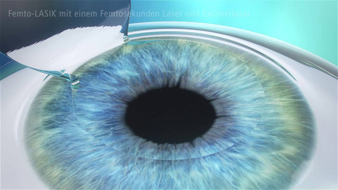 Auge-005-Femto