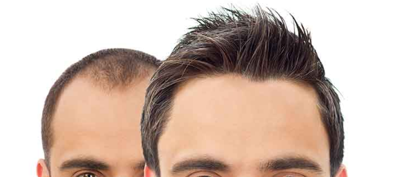 Haare-007